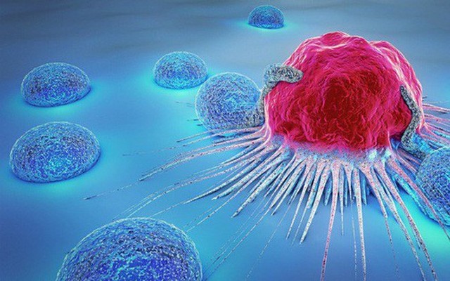  PCT Hội ung thư: Cảnh báo duy nhất một thói quen nhanh dẫn tới ung thư và cửa tử nhất - Ảnh 1.