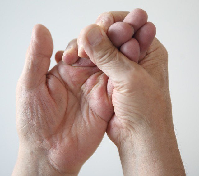 Đừng phớt lờ khi thường xuyên bị tê tay bởi bạn có thể mắc phải 8 căn bệnh nguy hiểm này - Ảnh 3.