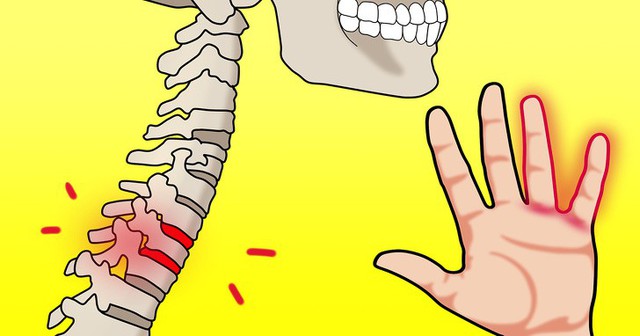 Đừng phớt lờ khi thường xuyên bị tê tay bởi bạn có thể mắc phải 8 căn bệnh nguy hiểm này - Ảnh 4.