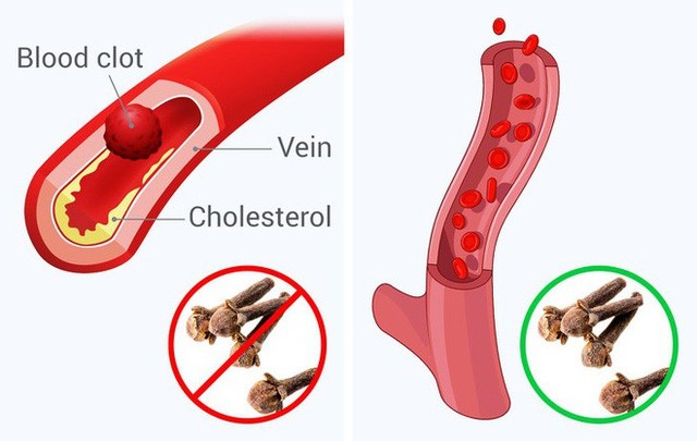 10 thay đổi tích cực trong cơ thể nếu ăn 2 nhánh gia vị này mỗi ngày: Hữu ích toàn thân - Ảnh 12.