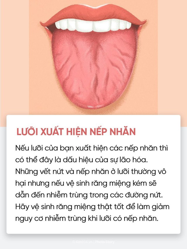 Nhìn vào lưỡi cũng có thể giúp bạn kiểm tra nhanh tình trạng sức khoẻ - Ảnh 3.