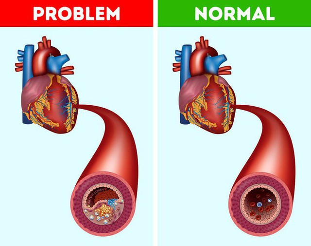  Cơ thể nhận được 8 lợi ích kỳ diệu khi ăn trái cây siêu thực phẩm này trong một tuần - Ảnh 6.