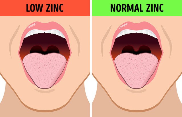 Chỉ dựa vào hơi thở, bạn có thể bắt mạch tình trạng sức khỏe của bản thân: Không chỉ đơn giản là vấn đề vệ sinh răng miệng! - Ảnh 3.