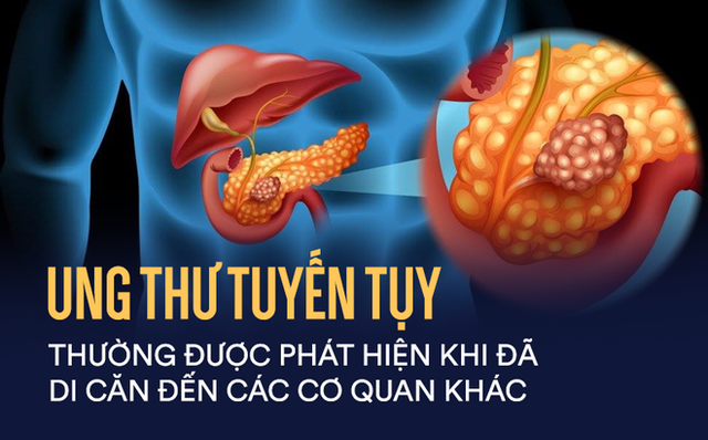  Căn bệnh ung thư cực kỳ nguy hiểm, tỷ lệ sống chỉ được 5%: Dấu hiệu nào nhận biết bệnh? - Ảnh 2.