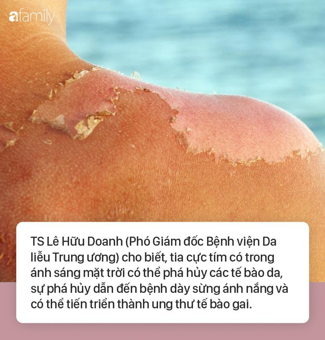 Chuyên gia da liễu hướng dẫn cách chống nắng hoàn hảo khi đi biển, ngăn chặn cháy nắng, bỏng nắng và cả ung thư da - Ảnh 1.