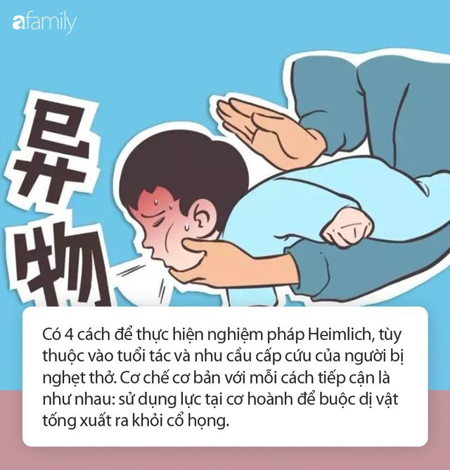 Cậu bé 6 tuổi tử vong sau khi ăn miếng bánh mì, bác sĩ chỉ phương pháp sơ cứu khi trẻ hóc dị vật ai cũng nên biết - Ảnh 2.