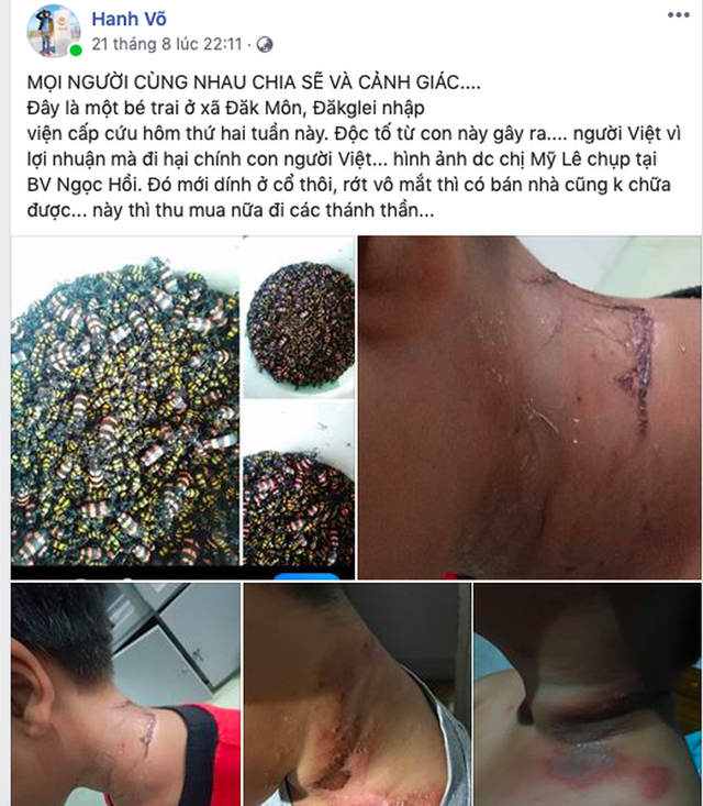 Việc thương lái lùng mua bọ 3 sọc độc hại giá cao:Đá bóng trách nhiệm quản lý - Ảnh 2.