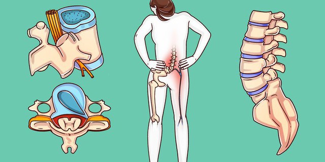 Bác sĩ phẫu thuật tiết lộ bài tập có thể giúp cột sống, thắt lưng của bạn khỏe mạnh trước khi mọi chuyện tồi tệ xảy ra - Ảnh 1. Bác sĩ phẫu thuật tiết lộ bài tập có thể giúp cột sống, thắt lưng của bạn khỏe mạnh trước khi mọi chuyện tồi tệ xảy ra - Ảnh 1.