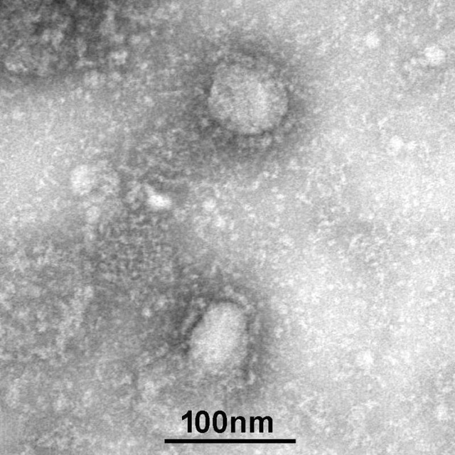  TQ công bố chân dung virus corona: Sự nguy hiểm chết người đằng sau tử thần nhỏ hơn cả bụi siêu mịn - Ảnh 1.