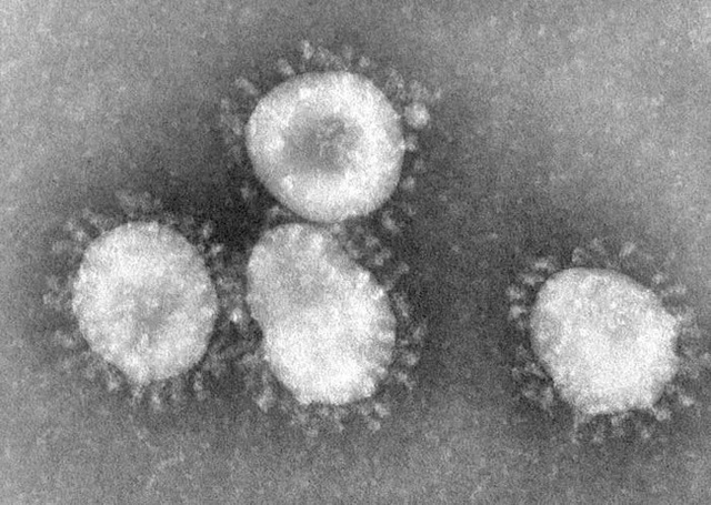 Thợ săn Virus: Những người đầu tiên tìm ra danh tính virus lạ, luôn phải đối mặt với sự nguy hiểm và hàng loạt áp lực từ công chúng - Ảnh 6.