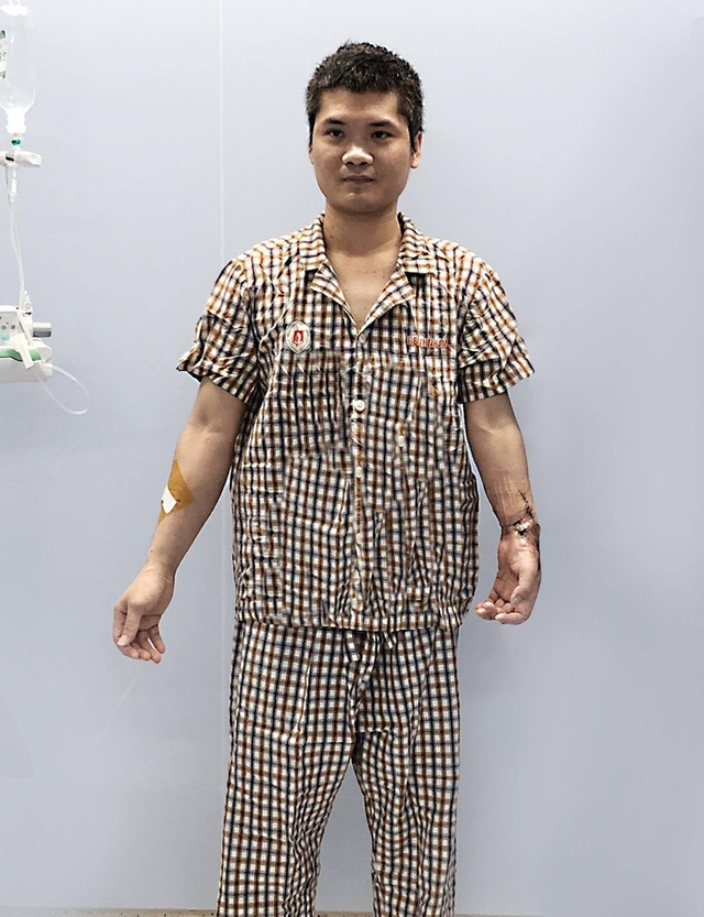  Việt Nam thực hiện thành công ca ghép chi thể đầu tiên trên thế giới từ người hiến sống  - Ảnh 5.