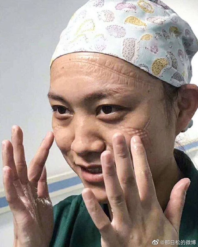 Gương mặt đầy vết hằn do khẩu trang, kính bảo hộ: Các y tá, bác sĩ ở Vũ Hán đã đánh cược cả tính mạng để chống lại đại dịch corona - Ảnh 6.