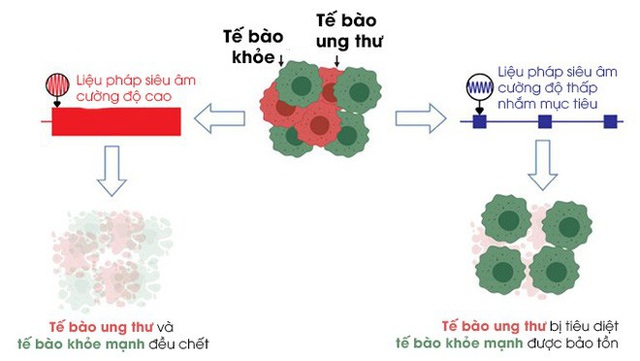 Kỹ thuật siêu âm mới có thể tiêu diệt tế bào ung thư dựa trên hiệu ứng sóng dừng - Ảnh 4.