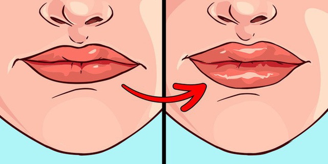 Cứ thấy xuất hiện 8 dấu hiệu này ở môi thì đừng chần chờ mà hãy đi khám gấp, đặc biệt là khi môi nhợt nhạt hoặc có đốm đen - Ảnh 7.