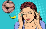 8 thực phẩm đẩy lùi chứng đau nửa đầu: Ngon bổ rẻ lại chữa được bệnh, tội gì không thử?