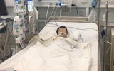 Bé trai 27 tháng tuổi nguy kịch, hỏng gan vì ngộ độc thuốc hạ sốt Paracetamol