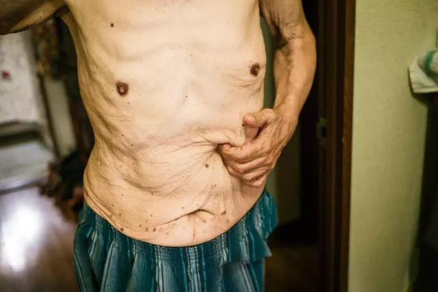 3 năm, 33 bức ảnh, nhiếp ảnh gia ghi lại quá trình trước khi cha từ giã cõi đời vì ung thư: Đừng để người thân một mình chống chọi  - Ảnh 13.