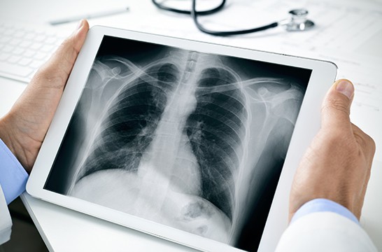 Việt Nam xây dựng thành công phần mềm đọc bệnh qua ảnh X quang: Hiệu quả cực cao, tạo đột phá mới trong ngành y tế - Ảnh 1.
