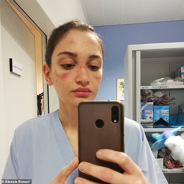 Thảm cảnh với y bác sĩ Vũ Hán tái diễn ở Italy: Nhân viên y tế tím mặt vì đeo khẩu trang, ngủ gục trên bàn vì kiệt sức - Ảnh 1.