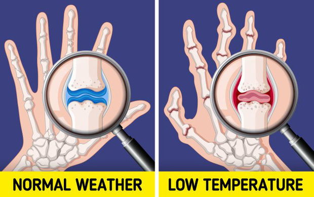 Đừng coi thường sưng tấy do nắng nóng hay da khô nứt nẻ vì giá lạnh, thời tiết có thể gây ra những tác hại đáng sợ thế này với cơ thể - Ảnh 5.