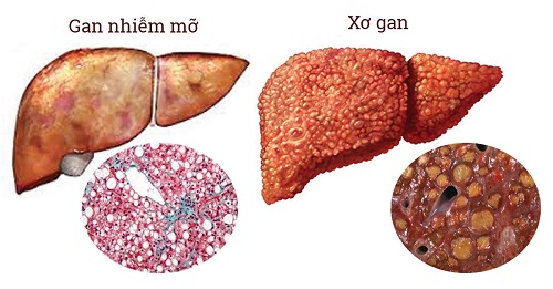  Từ giải Nobel Y Sinh 2020: GS Đào Văn Long phân tích căn bệnh nguy hiểm 1 triệu người Việt đang mắc - Ảnh 1.