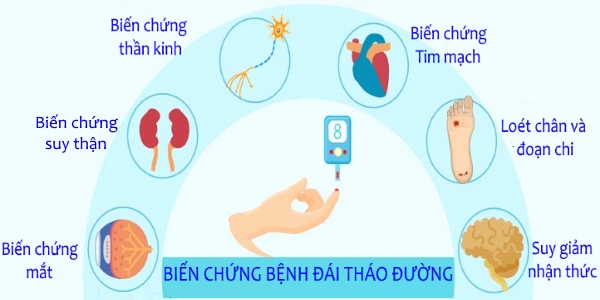 Người bệnh tiểu đường còn rất chủ quan: Chuyên gia chỉ rõ 3 biến chứng nguy hiểm nhất cần điều trị cấp cứu - Ảnh 1.