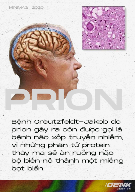 Những cái chết thầm lặng vì nhiễm prion: Phân tử thây ma âm thầm biến não bộ thành bọt biển - Ảnh 5.