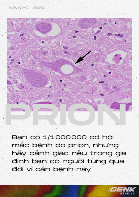 Những cái chết thầm lặng vì nhiễm prion: Phân tử thây ma âm thầm biến não bộ thành bọt biển - Ảnh 10.