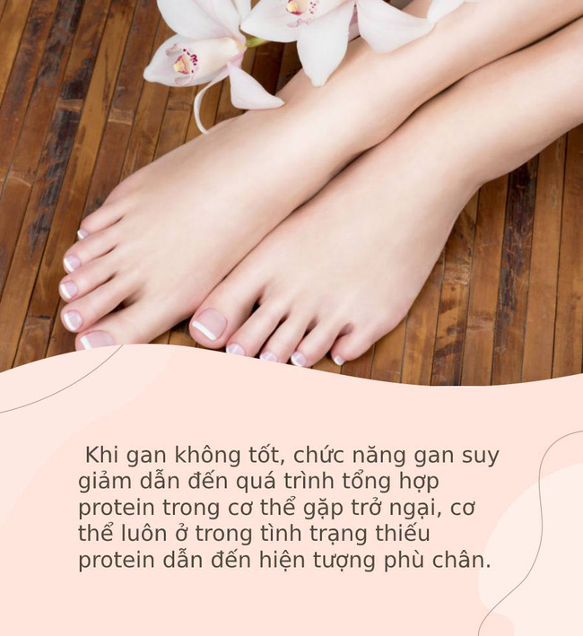 Bàn chân giống như &quot;đồng hồ sức khỏe&quot;: 3 dấu hiệu này trên bàn chân cho biết rất có thể gan của bạn đang gặp vấn đề