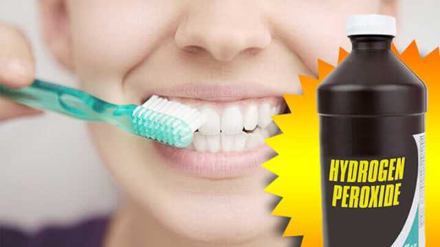Học cách sử dụng hdrogen peroxide để làm trắng răng như trên Tik Tok: Chuyên gia khuyến cáo cần hết sức cẩn trọng! - Ảnh 2.