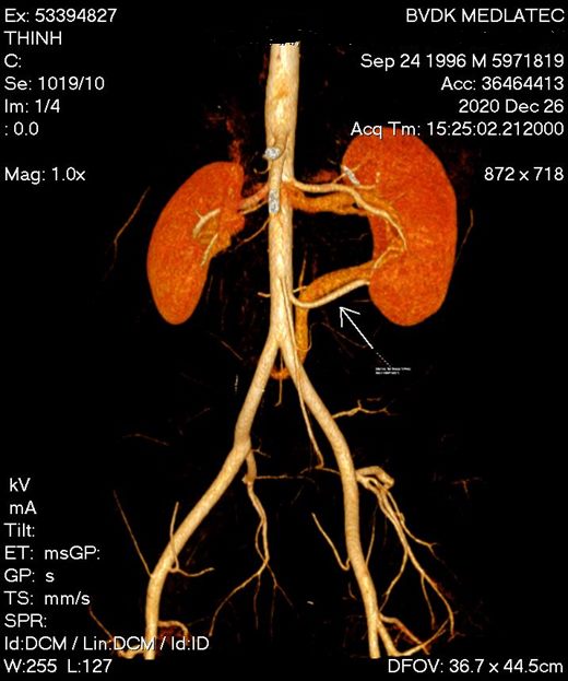 Nephron Chức năng của ống thận  Khoa Y dược Hà Nội