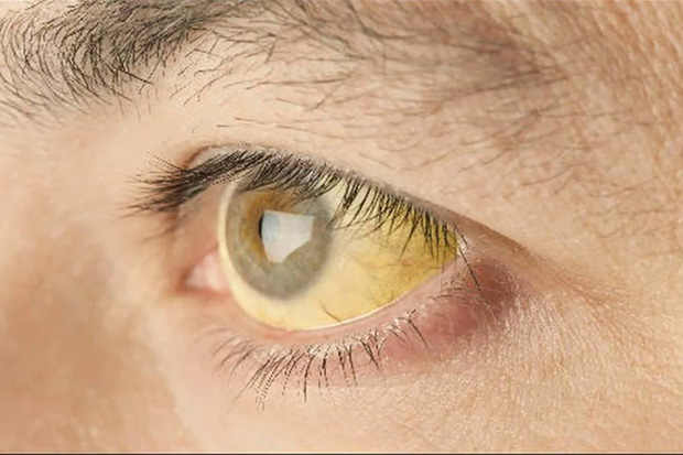 2 dấu hiệu bất thường ở mắt sẽ giúp bạn phán đoán nguy cơ ung thư từ giai đoạn đầu - Ảnh 1.