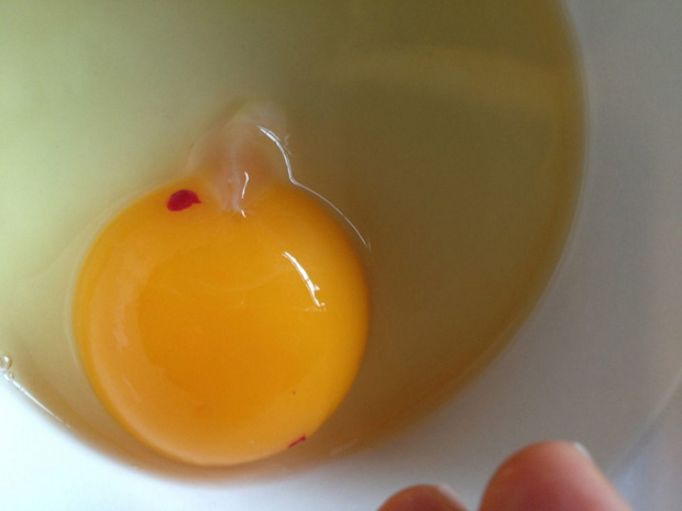 4 kiểu trứng hỏng gây hại cho sức khỏe nhưng nhiều người vẫn tiếc rẻ mà cố ăn - Ảnh 3.