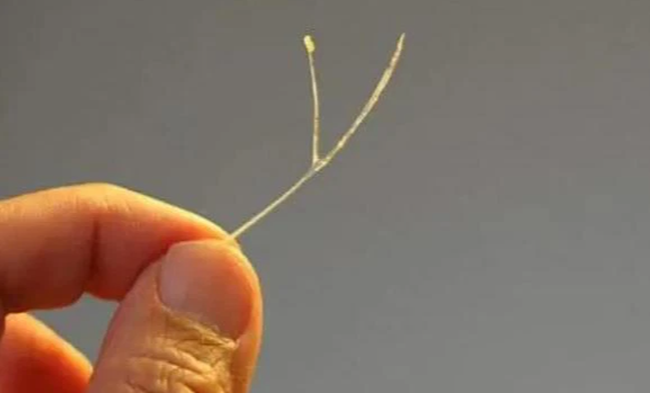 Con trai 4 tuổi hóc xương cá, bố kiên quyết không làm 3 việc để cứu mạng  con, bác sĩ hết lời khen ngợi