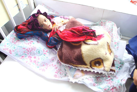 Tuyệt vọng vì tiền, các gia đình Afghanistan phải gả bán con gái nhỏ để tránh cả nhà chết đói - Ảnh 2.