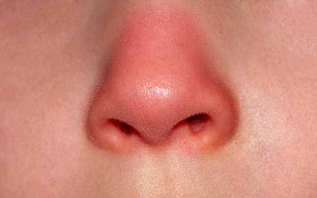  Mũi là đèn tín hiệu của phổi: Nếu mũi xuất hiện 3 dấu hiệu lạ thì bạn nên đi kiểm tra phổi ngay - Ảnh 1.