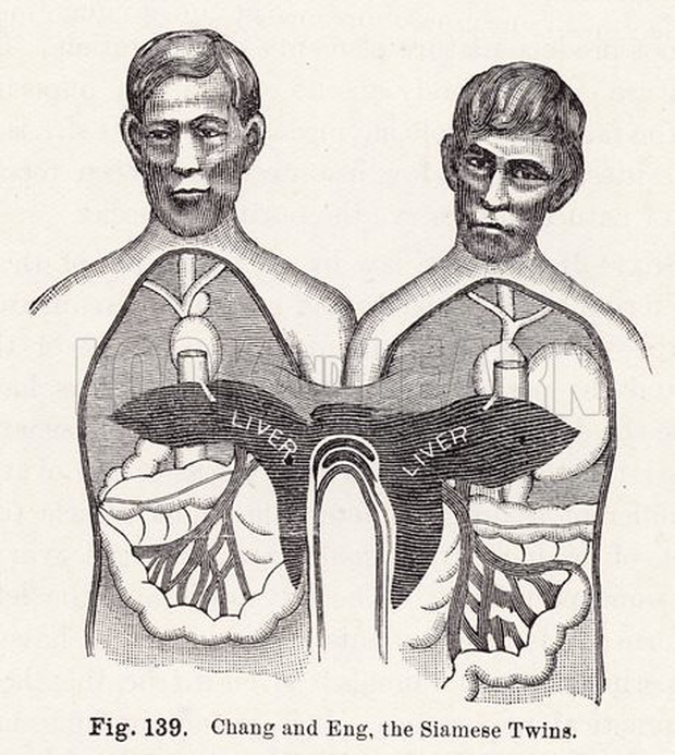 Cặp sinh đôi dính liền nổi tiếng nhất lịch sử: Bị gọi là “quái vật” nhưng vẫn thành công rực rỡ, gây tò mò khi lấy 2 vợ riêng biệt, sinh tù tì 21 con - Ảnh 5.
