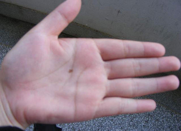 Những người gan tốt thường không có 3 biểu hiện này trên tay, kiểm tra ngay để nắm được tình hình sức khỏe - Ảnh 2.