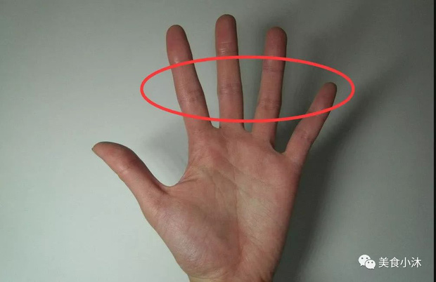 Những người gan tốt thường không có 3 biểu hiện này trên tay, kiểm tra ngay để nắm được tình hình sức khỏe - Ảnh 3.