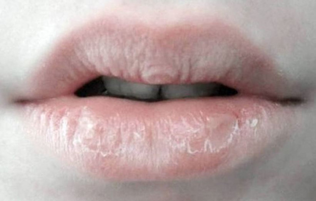 Người gan kém thường có 4 biểu hiện bất thường ở quanh miệng, nếu bạn không có thì xin chúc mừng - Ảnh 1.