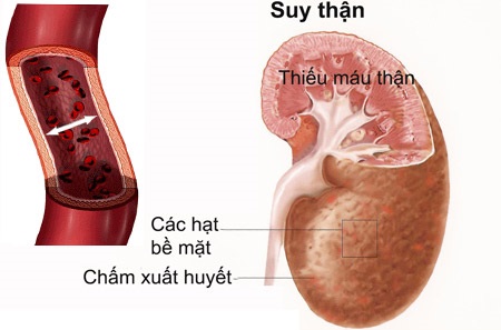 Dịch COVID quay trở lại, bạn cần biết 9 nhóm bệnh nền chính - Ảnh 3.