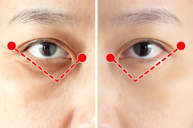  Bài tập 1 phút của người Nhật để ngăn ngừa và loại bỏ nếp nhăn quanh mắt cực hiệu quả - Ảnh 2.