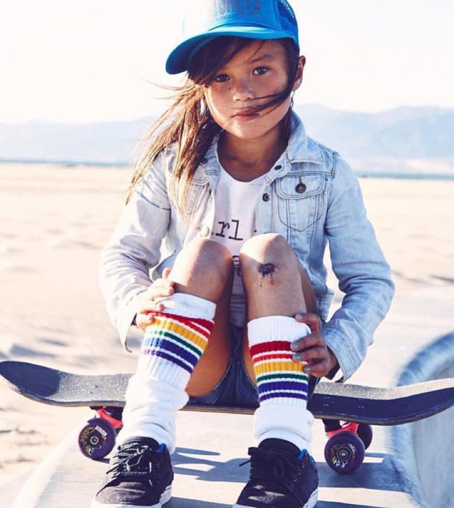 VĐV đặc biệt nhất Olympic Tokyo 2020: 13 tuổi trượt ván siêu đẳng, chấn thương đến rạn xương sọ, rách phổi vẫn hiên ngang làm nên kỳ tích - Ảnh 2. VĐV đặc biệt nhất Olympic Tokyo 2020: 13 tuổi trượt ván siêu đẳng, chấn thương đến rạn xương sọ, rách phổi vẫn hiên ngang làm nên kỳ tích - Ảnh 2.