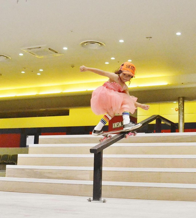 VĐV đặc biệt nhất Olympic Tokyo 2020: 13 tuổi trượt ván siêu đẳng, chấn thương đến rạn xương sọ, rách phổi vẫn hiên ngang làm nên kỳ tích - Ảnh 3. VĐV đặc biệt nhất Olympic Tokyo 2020: 13 tuổi trượt ván siêu đẳng, chấn thương đến rạn xương sọ, rách phổi vẫn hiên ngang làm nên kỳ tích - Ảnh 3.