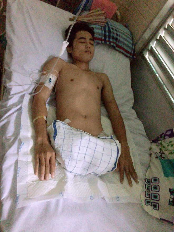 Nghị lực phi thường của chàng trai phải cưa cụt đôi chân ở tuổi 25 và hành trình trao yêu thương giữa dịch Covid-19 - Ảnh 3. Nghị lực phi thường của chàng trai phải cưa cụt đôi chân ở tuổi 25 và hành trình trao yêu thương giữa dịch Covid-19 - Ảnh 3.