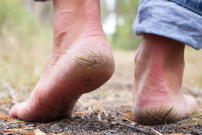 8 dấu hiệu trên bàn chân cảnh báo cơ thể bạn đang lão hoá dần - Ảnh 1.