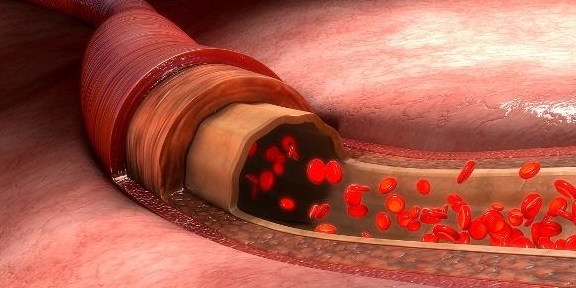 Người có mạch máu khỏe mạnh thường không làm 5 việc này, nếu bạn cũng giống họ thì có thể phòng được nhiều bệnh - Ảnh 3.