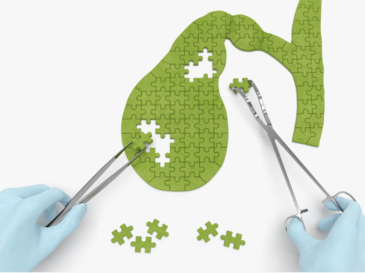 Đắng miệng, khô cổ họng làm bạn “mất ngủ” mỗi đêm: Đừng chủ quan, đó có thể là dấu hiệu của 5 vấn đề sức khỏe nghiêm trọng này - Ảnh 5. Đắng miệng, khô cổ họng làm bạn “mất ngủ” mỗi đêm: Đừng chủ quan, đó có thể là dấu hiệu của 5 vấn đề sức khỏe nghiêm trọng này - Ảnh 5.