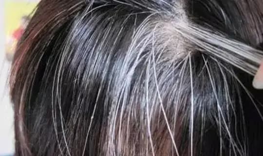 Tóc trắng mọc trên trán, thái dương và sau đầu cảnh báo điều gì? Làm được 4 việc này tóc trắng còn lâu mới xuất hiện - Ảnh 3.
