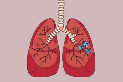 2 chỗ “lồi” trên cơ thể là dấu hiệu cảnh báo phổi yếu, dễ bị ung thư: Có 3 loại khí này trong nhà mà không thanh tẩy sớm thì chẳng mấy chốc mà nhập viện - Ảnh 1.